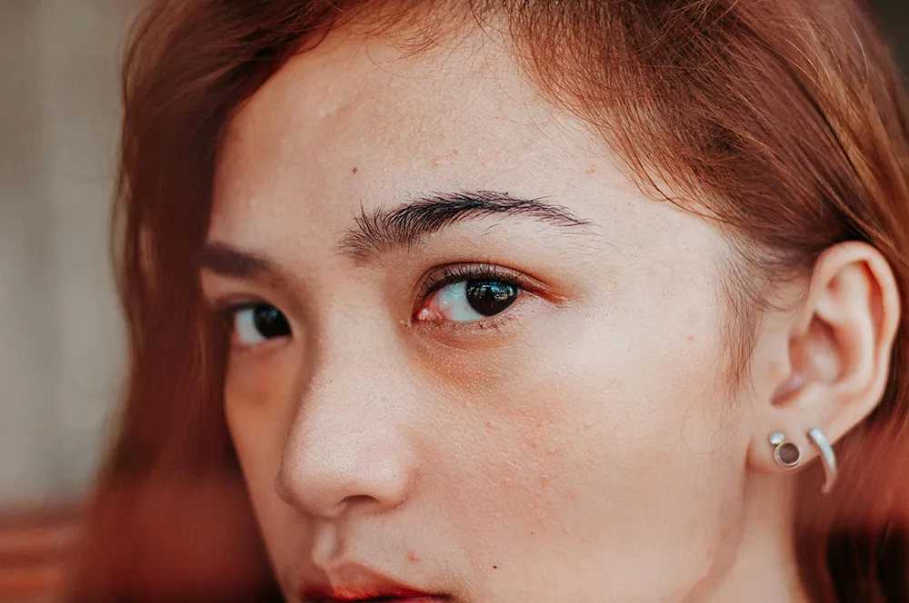 A woman about to receive an eyebrow treatment.